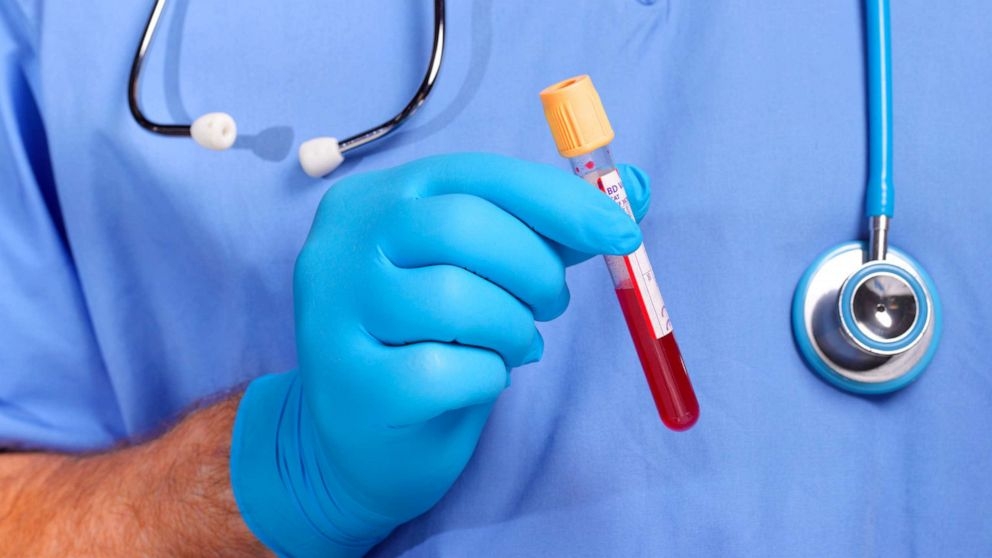 اختبار دم يمنع الإجهاض التلقائي!