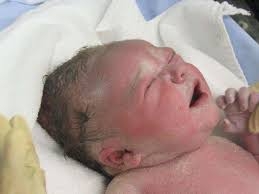 ولادة طفل حاملاً جهاز منع الحمل الذي لم تفلح والدته في استخدامه!